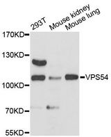 VPS54 Antibody - Western blot analysis of extracts of various cell lines, using VPS54 antibody at 1:3000 dilution. The secondary antibody used was an HRP Goat Anti-Rabbit IgG (H+L) at 1:10000 dilution. Lysates were loaded 25ug per lane and 3% nonfat dry milk in TBST was used for blocking. An ECL Kit was used for detection and the exposure time was 90s.