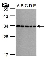 Vps60 / CHMP5 Antibody - Sample (30g whole cell lysate). A:293T, B: A431 , C: H1299, D: HeLa S3 , E: Hep G2 . 12% SDS PAGE. Vps60 / CHMP5 antibody diluted at 1:1000