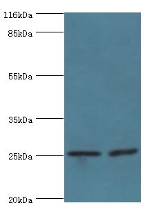 Vps60 / CHMP5 Antibody - Western blot. All lanes: Charged multivesicular body protein 5 antibody at 2 ug/ml Lane 1:293T whole cell lysate. Lane 2: K562 whole cell lysate. Secondary antibody: Goat polyclonal to rabbit at 1:10000 dilution. Predicted band size: 25 kDa. Observed band size: 25 kDa.  This image was taken for the unconjugated form of this product. Other forms have not been tested.