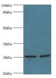 Vps60 / CHMP5 Antibody - Western blot. All lanes: Charged multivesicular body protein 5 antibody at 2 ug/ml Lane 1:293T whole cell lysate. Lane 2: K562 whole cell lysate. Secondary antibody: Goat polyclonal to rabbit at 1:10000 dilution. Predicted band size: 25 kDa. Observed band size: 25 kDa.  This image was taken for the unconjugated form of this product. Other forms have not been tested.