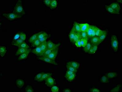 Vps60 / CHMP5 Antibody - Immunofluorescence staining of HepG2 cells with CHMP5 Antibody at 1:266, counter-stained with DAPI. The cells were fixed in 4% formaldehyde, permeabilized using 0.2% Triton X-100 and blocked in 10% normal Goat Serum. The cells were then incubated with the antibody overnight at 4°C. The secondary antibody was Alexa Fluor 488-congugated AffiniPure Goat Anti-Rabbit IgG(H+L).