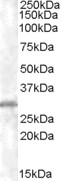 Vps60 / CHMP5 Antibody - Antibody staining (0.5 ug/ml) of K562 lysate (35 ug protein in RIPA buffer). Primary incubation was 1 hour. Detected by chemiluminescence.
