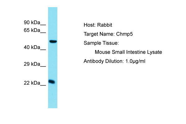 Vps60 / CHMP5 Antibody -  This image was taken for the unconjugated form of this product. Other forms have not been tested.