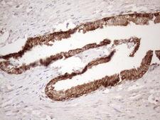 Vps60 / CHMP5 Antibody - Immunohistochemical staining of paraffin-embedded Human prostate tissue within the normal limits using anti-CHMP5 mouse monoclonal antibody. (Heat-induced epitope retrieval by 1mM EDTA in 10mM Tris buffer. (pH8.5) at 120 oC for 3 min. (1:150)