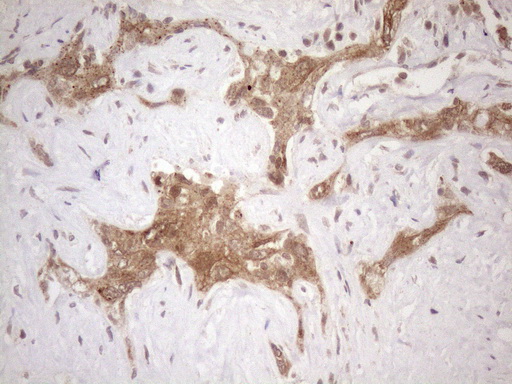 Vps60 / CHMP5 Antibody - Immunohistochemical staining of paraffin-embedded Human liver tissue within the normal limits using anti-CHMP5 mouse monoclonal antibody. (Heat-induced epitope retrieval by 1mM EDTA in 10mM Tris buffer. (pH8.5) at 120 oC for 3 min. (1:150)