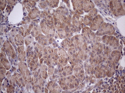 Vps60 / CHMP5 Antibody - Immunohistochemical staining of paraffin-embedded Human pancreas tissue within the normal limits using anti-CHMP5 mouse monoclonal antibody. (Heat-induced epitope retrieval by Tris-EDTA, pH8.0)(1:150)