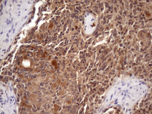 Vps60 / CHMP5 Antibody - Immunohistochemical staining of paraffin-embedded Human thyroid tissue within the normal limits using anti-CHMP5 mouse monoclonal antibody. (Heat-induced epitope retrieval by Tris-EDTA, pH8.0)(1:150)