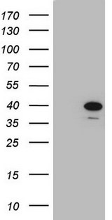 Vps60 / CHMP5 Antibody - HEK293T cells were transfected with the pCMV6-ENTRY control. (Left lane) or pCMV6-ENTRY CHMP5. (Right lane) cDNA for 48 hrs and lysed