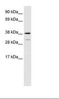 VPS72 Antibody - Fetal Lung Lysate.  This image was taken for the unconjugated form of this product. Other forms have not been tested.