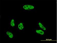 VPS72 Antibody - Immunofluorescence of monoclonal antibody to VPS72 on HeLa cell . [antibody concentration 10 ug/ml]