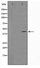 VPS72 Antibody - Western blot of RAW264.7 cell lysate using VPS72 Antibody
