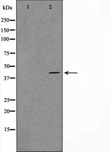 VPS72 Antibody - Western blot analysis on RAW264.7 cell lysates using VPS72 antibody. The lane on the left is treated with the antigen-specific peptide.