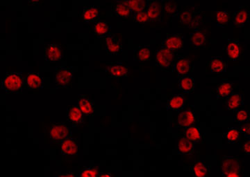 VPS72 Antibody - Staining RAW264.7 cells by IF/ICC. The samples were fixed with PFA and permeabilized in 0.1% Triton X-100, then blocked in 10% serum for 45 min at 25°C. The primary antibody was diluted at 1:200 and incubated with the sample for 1 hour at 37°C. An Alexa Fluor 594 conjugated goat anti-rabbit IgG (H+L) Ab, diluted at 1/600, was used as the secondary antibody.