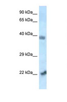 VPS72 Antibody - VPS72 antibody Western blot of Mouse Heart lysate. Antibody concentration 1 ug/ml.  This image was taken for the unconjugated form of this product. Other forms have not been tested.