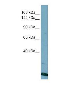 VPS8 Antibody - Western blot of Human HT1080. VPS8 antibody dilution 1.0 ug/ml.  This image was taken for the unconjugated form of this product. Other forms have not been tested.