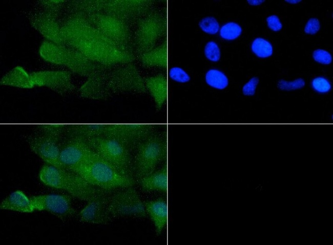 VR1 / TRPV1 Antibody - Immunocytochemistry/Immunofluorescence: TRPV1 Antibody - TRPV1 antibody was tested at 1:50 in HeLa cells with FITC (green). Nuclei were counterstained with Dapi (blue).  This image was taken for the unconjugated form of this product. Other forms have not been tested.