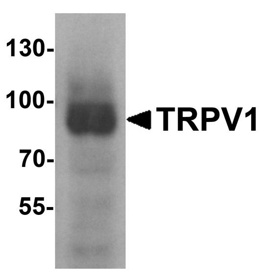 VR1 / TRPV1 Antibody - Western blot analysis of TRPV1 in K562 cell lysate with TRPV1 antibody at 1 ug/ml.