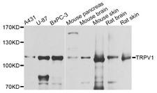 VR1 / TRPV1 Antibody - Western blot analysis of extracts of various cell lines.