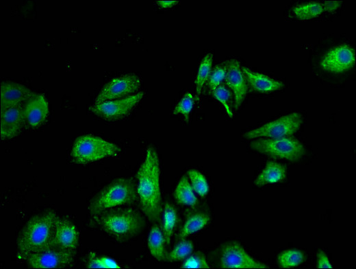 VR1 / TRPV1 Antibody - Immunofluorescent analysis of HepG2 cells using TRPV1 Antibody at a dilution of 1:100 and Alexa Fluor 488-congugated AffiniPure Goat Anti-Rabbit IgG(H+L)