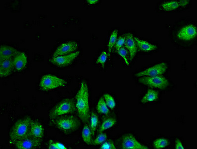 VR1 / TRPV1 Antibody - Immunofluorescent analysis of HepG2 cells using TRPV1 Antibody at dilution of 1:100 and Alexa Fluor 488-congugated AffiniPure Goat Anti-Rabbit IgG(H+L)