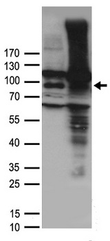 VR1 / TRPV1 Antibody - HEK293T cells were transfected with the pCMV6-ENTRY control. (Left lane) or pCMV6-ENTRY TRPV1. (Right lane) cDNA for 48 hrs and lysed