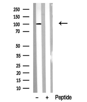VR1 / TRPV1 Antibody - Western blot analysis of extracts of human skin tissue sample using VR1 antibody.