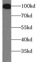 VR1 / TRPV1 Antibody - PC-12 cells were subjected to SDS PAGE followed by western blot with TRPV1 antibody at dilution of 1:1000