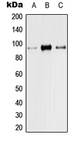 VR1 / TRPV1 Antibody - Western blot analysis of TRPV1 expression in HeLa (A); Raw264.7 (B); PC12 (C) whole cell lysates.