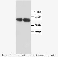 VR1 / TRPV1 Antibody -  This image was taken for the unconjugated form of this product. Other forms have not been tested.