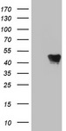 VRK1 Antibody - HEK293T cells were transfected with the pCMV6-ENTRY control (Left lane) or pCMV6-ENTRY VRK1 (Right lane) cDNA for 48 hrs and lysed. Equivalent amounts of cell lysates (5 ug per lane) were separated by SDS-PAGE and immunoblotted with anti-VRK1.