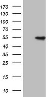 VRK1 Antibody - HEK293T cells were transfected with the pCMV6-ENTRY control. (Left lane) or pCMV6-ENTRY VRK1. (Right lane) cDNA for 48 hrs and lysed. Equivalent amounts of cell lysates. (5 ug per lane) were separated by SDS-PAGE and immunoblotted with anti-VRK1.