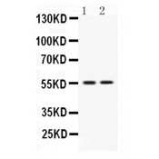 VRK1 Antibody - Western blot analysis of VRK1 expression in rat thymus extract (lane 1) and JURKAT whole cell lysates (lane 2). VRK1 at 55 kD was detected using rabbit anti- VRK1 Antigen Affinity purified polyclonal antibody at 0.5 ug/mL. The blot was developed using chemiluminescence (ECL) method.
