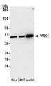 VRK1 Antibody - Detection of human VRK1 by western blot. Samples: Whole cell lysate (15 µg) from HeLa, HEK293T, and Jurkat cells prepared using NETN lysis buffer. Antibody: Affinity purified rabbit anti-VRK1 antibody used for WB at 0.1 µg/ml. Detection: Chemiluminescence with an exposure time of 3 minutes.
