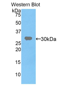 VRK1 Antibody - Western blot of recombinant VRK1.  This image was taken for the unconjugated form of this product. Other forms have not been tested.
