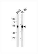 VRK1 Antibody - VRK1 Antibody western blot of HeLa,HL-60 cell line lysates (35 ug/lane). The VRK1 antibody detected the VRK1 protein (arrow).