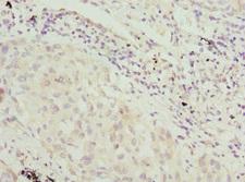 VRK1 Antibody - Immunohistochemistry of paraffin-embedded human lung tissue at dilution 1:100