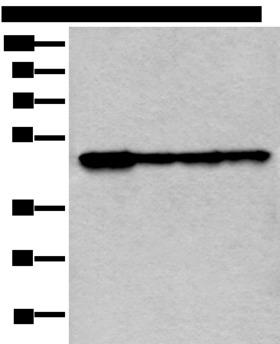 VRK1 Antibody - Western blot analysis of 293T and 231 cell lysates  using VRK1 Polyclonal Antibody at dilution of 1:400