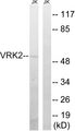 VRK2 Antibody - Western blot analysis of lysates from Jurkat cells, using VRK2 Antibody. The lane on the right is blocked with the synthesized peptide.