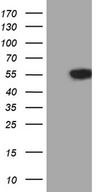VRK2 Antibody - HEK293T cells were transfected with the pCMV6-ENTRY control. (Left lane) or pCMV6-ENTRY VRK2. (Right lane) cDNA for 48 hrs and lysed
