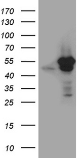 VRK2 Antibody - HEK293T cells were transfected with the pCMV6-ENTRY control. (Left lane) or pCMV6-ENTRY VRK2. (Right lane) cDNA for 48 hrs and lysed. Equivalent amounts of cell lysates. (5 ug per lane) were separated by SDS-PAGE and immunoblotted with anti-VRK2. (1:2000)
