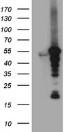 VRK2 Antibody - HEK293T cells were transfected with the pCMV6-ENTRY control. (Left lane) or pCMV6-ENTRY VRK2. (Right lane) cDNA for 48 hrs and lysed