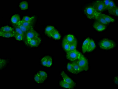 VRK2 Antibody - Immunofluorescence staining of HepG2 cells diluted at 1:200, counter-stained with DAPI. The cells were fixed in 4% formaldehyde, permeabilized using 0.2% Triton X-100 and blocked in 10% normal Goat Serum. The cells were then incubated with the antibody overnight at 4°C.The Secondary antibody was Alexa Fluor 488-congugated AffiniPure Goat Anti-Rabbit IgG (H+L).