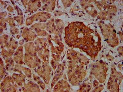 VRK2 Antibody - Immunohistochemistry Dilution at 1:600 and staining in paraffin-embedded human pancreatic tissue performed on a Leica BondTM system. After dewaxing and hydration, antigen retrieval was mediated by high pressure in a citrate buffer (pH 6.0). Section was blocked with 10% normal Goat serum 30min at RT. Then primary antibody (1% BSA) was incubated at 4°C overnight. The primary is detected by a biotinylated Secondary antibody and visualized using an HRP conjugated SP system.