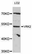 VRK2 Antibody - Western blot analysis of extracts of LO2 cells, using VRK2 antibody at 1:3000 dilution. The secondary antibody used was an HRP Goat Anti-Rabbit IgG (H+L) at 1:10000 dilution. Lysates were loaded 25ug per lane and 3% nonfat dry milk in TBST was used for blocking. An ECL Kit was used for detection and the exposure time was 90s.