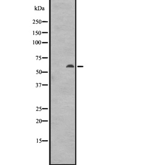 VRK2 Antibody - Western blot analysis of VRK2 expression in Jurkat cells lysate. The lane on the left is treated with the antigen-specific peptide.