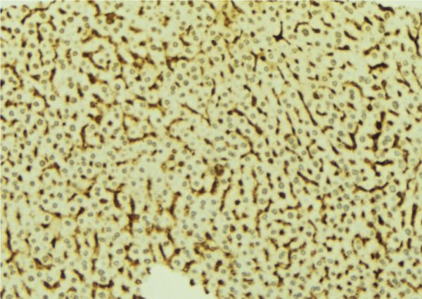 VRK2 Antibody - 1:100 staining mouse liver tissue by IHC-P. The sample was formaldehyde fixed and a heat mediated antigen retrieval step in citrate buffer was performed. The sample was then blocked and incubated with the antibody for 1.5 hours at 22°C. An HRP conjugated goat anti-rabbit antibody was used as the secondary.