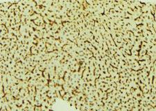 VRK2 Antibody - 1:100 staining mouse liver tissue by IHC-P. The sample was formaldehyde fixed and a heat mediated antigen retrieval step in citrate buffer was performed. The sample was then blocked and incubated with the antibody for 1.5 hours at 22°C. An HRP conjugated goat anti-rabbit antibody was used as the secondary.