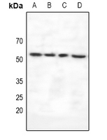 VRK3 Antibody - Western blot analysis of VRK3 expression in HEK293T (A), A549 (B), U87MG (C), rat liver (D) whole cell lysates.
