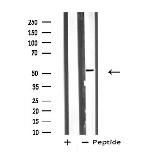 VRK3 Antibody - Western blot analysis of extracts of COLO205 cells using VRK3 antibody.