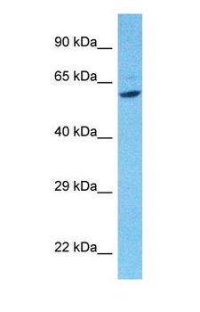 VRK3 Antibody - Western blot of VRK3 Antibody with human 786-0 Whole Cell lysate.  This image was taken for the unconjugated form of this product. Other forms have not been tested.